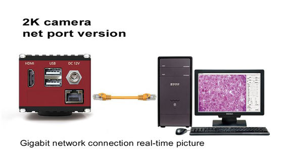 Câmara digital do microscópio de HDMI 60FPS com interface de rede do gigabit